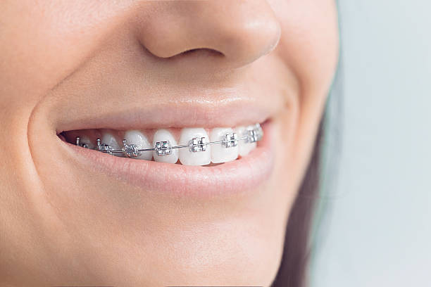 Best Dental Inlays and Onlays  in Clifton, TX